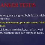 Risiko Kanker Testis Pada Pria Muda Memahami Mengenali Dan Bertindak