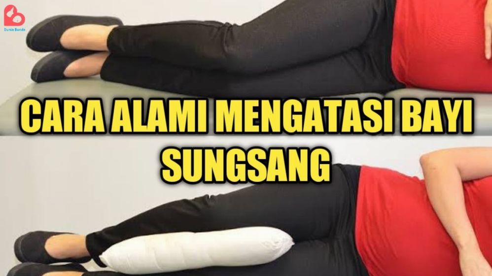 Bagaimana Cara Membalikkan Bayi Sungsang Secara Alami