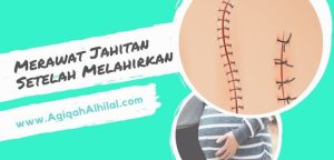 Bagaimana Cara Merawat Jahitan Setelah Melahirkan Normal