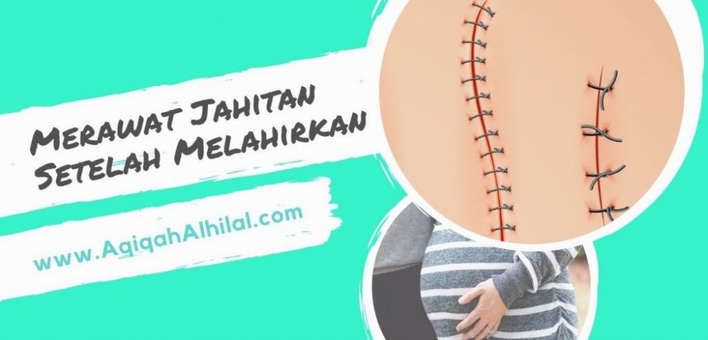 Bagaimana Cara Merawat Jahitan Setelah Melahirkan Normal